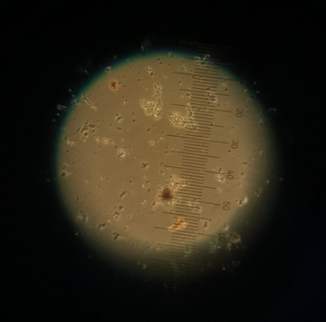 Diatoms in Microscope
