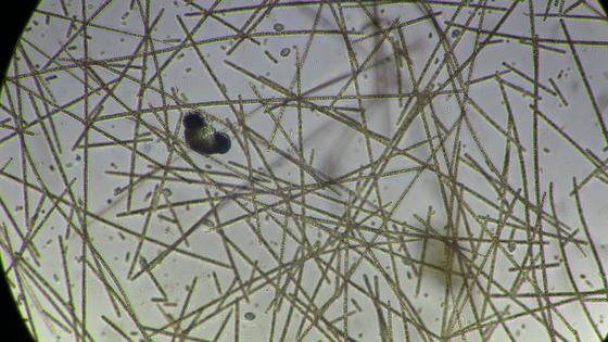 Algae under the Microscope